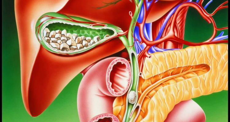 Продукты для профилактики камней в желчном пузыре: что есть, чтобы избежать проблем