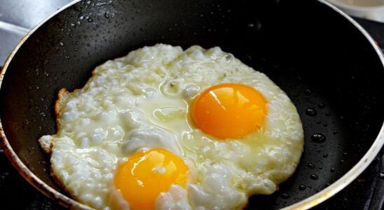 Пять продуктов, которые стоит исключить при жирной коже: советы нутрициологов