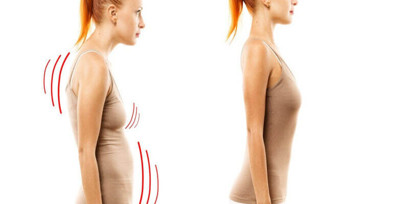 Хорошая осанка: миф или ключ к здоровой спине?