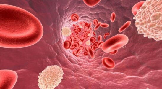 Повышенный холестерин: как распознать и что делать