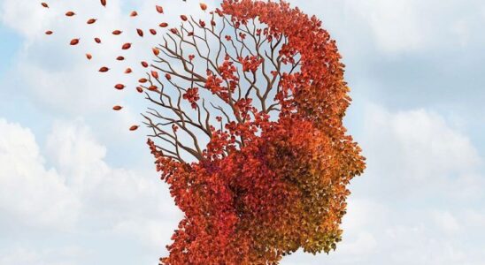 Ранние признаки деменции: на что стоит обратить внимание женщинам