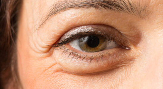 Какие продукты вызывают отеки перед сном: полный список и рекомендации