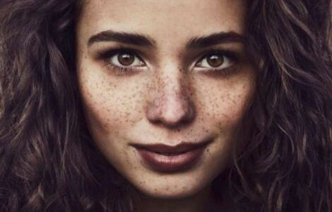 Борьба с веснушками и пигментными пятнами: эффективные методы и уход