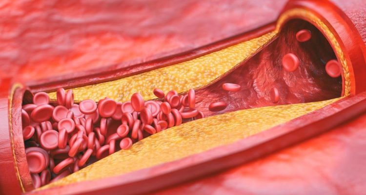 5 мифов о холестерине, в которые вы верите: развенчиваем ошибки