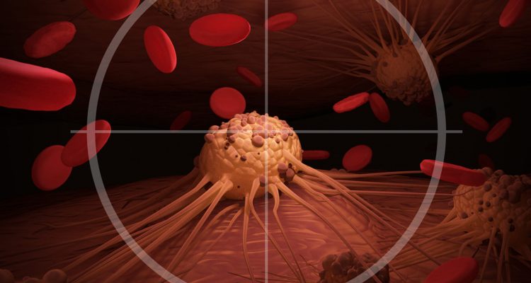 5 простых шагов к здоровью: профилактика рака для каждой женщины