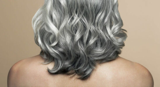 Почему седеют волосы в молодости: мнение трихолога