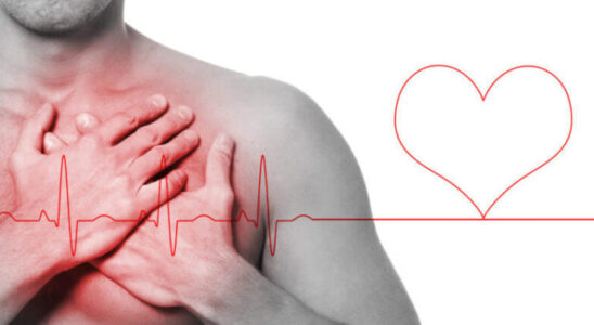 Внезапная остановка сердца: причины и профилактика