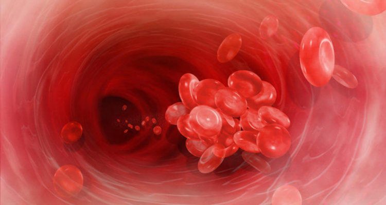 Тревожные симптомы тромбоза: как распознать опасность для ног